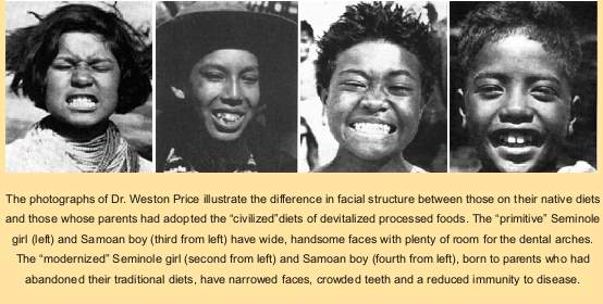 teeth_photo